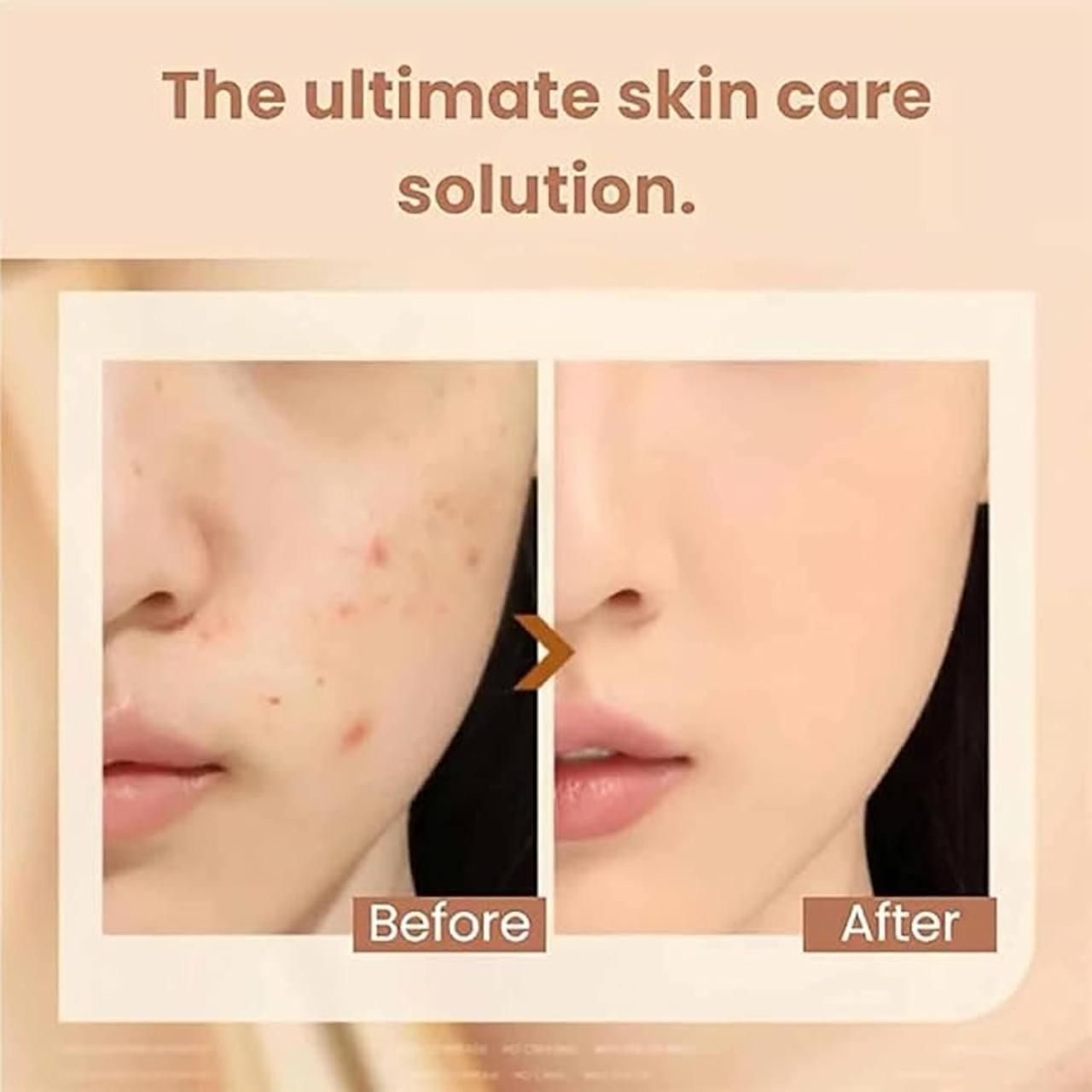 Before and after comparison of skin care solution on a person's face.